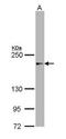 Nuclear Receptor Coactivator 3 antibody, PA5-29854, Invitrogen Antibodies, Western Blot image 