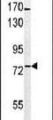 Bardet-Biedl Syndrome 10 antibody, PA5-24806, Invitrogen Antibodies, Western Blot image 