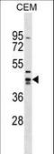 Zinc Finger And SCAN Domain Containing 9 antibody, LS-C157420, Lifespan Biosciences, Western Blot image 