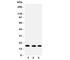 Ubiquitin Conjugating Enzyme E2 I antibody, R31382, NSJ Bioreagents, Western Blot image 