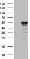 Zinc Finger Protein 500 antibody, CF803375, Origene, Western Blot image 