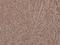 BCL2 Associated Agonist Of Cell Death antibody, A03520S112, Boster Biological Technology, Immunohistochemistry paraffin image 