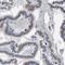 Solute Carrier Family 37 Member 2 antibody, HPA014948, Atlas Antibodies, Immunohistochemistry frozen image 