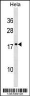 SCAN Domain Containing 1 antibody, 58-883, ProSci, Western Blot image 