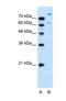 Solute Carrier Family 26 Member 1 antibody, NBP1-59408, Novus Biologicals, Western Blot image 