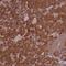 Coatomer Protein Complex Subunit Epsilon antibody, NBP2-38512, Novus Biologicals, Immunohistochemistry paraffin image 