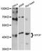 Speckle Type BTB/POZ Protein antibody, STJ114000, St John
