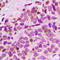 G Protein Nucleolar 3 Like antibody, LS-C356064, Lifespan Biosciences, Immunohistochemistry paraffin image 