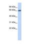 UDP Glucuronosyltransferase Family 2 Member B15 antibody, NBP1-69700, Novus Biologicals, Western Blot image 