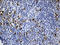 Cytotoxic T-lymphocyte protein 4 antibody, TA810299, Origene, Immunohistochemistry paraffin image 