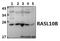 RAS Like Family 10 Member B antibody, GTX66819, GeneTex, Western Blot image 