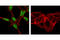 Androgen Receptor antibody, 5153T, Cell Signaling Technology, Immunocytochemistry image 