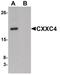 CXXC Finger Protein 4 antibody, PA5-21054, Invitrogen Antibodies, Western Blot image 