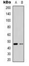 Oxoeicosanoid Receptor 1 antibody, orb339179, Biorbyt, Western Blot image 