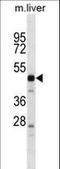 Serine Protease 16 antibody, LS-C162190, Lifespan Biosciences, Western Blot image 