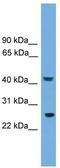 RAB35, Member RAS Oncogene Family antibody, TA340143, Origene, Western Blot image 