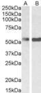 Polypyrimidine Tract Binding Protein 1 antibody, orb18567, Biorbyt, Western Blot image 