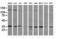 Mitogen-Activated Protein Kinase Kinase 3 antibody, LS-C174453, Lifespan Biosciences, Western Blot image 