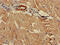 Propionyl-CoA Carboxylase Subunit Alpha antibody, CSB-PA017522LA01HU, Cusabio, Immunohistochemistry paraffin image 