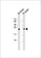 RAB3A, Member RAS Oncogene Family antibody, M03463, Boster Biological Technology, Western Blot image 