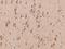 Trinucleotide Repeat Containing Adaptor 6B antibody, 204692-T08, Sino Biological, Immunohistochemistry paraffin image 