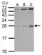 Placental Growth Factor antibody, PA5-27303, Invitrogen Antibodies, Western Blot image 