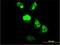 Centromere Protein M antibody, H00079019-M01, Novus Biologicals, Immunofluorescence image 