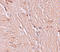 Zinc finger and BTB domain-containing protein 4 antibody, A08155, Boster Biological Technology, Immunohistochemistry paraffin image 