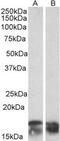 CD247 Molecule antibody, MBS423386, MyBioSource, Western Blot image 