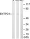 Ectonucleoside Triphosphate Diphosphohydrolase 1 antibody, A30668, Boster Biological Technology, Western Blot image 