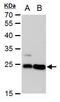 Lin-7 Homolog A, Crumbs Cell Polarity Complex Component antibody, MA5-18298, Invitrogen Antibodies, Western Blot image 