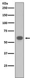 TNF Receptor Associated Factor 6 antibody, M00185-1, Boster Biological Technology, Western Blot image 