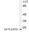 Stathmin 1 antibody, LS-C178026, Lifespan Biosciences, Western Blot image 