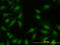 MAPK Activated Protein Kinase 2 antibody, LS-C133109, Lifespan Biosciences, Immunofluorescence image 