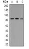 T Cell Activation RhoGTPase Activating Protein antibody, orb382483, Biorbyt, Western Blot image 