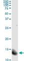 Fatty Acid Binding Protein 4 antibody, H00002167-M01, Novus Biologicals, Immunoprecipitation image 