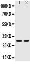 Kallikrein 1 antibody, GTX12017, GeneTex, Western Blot image 