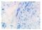 Interleukin 3 Receptor Subunit Alpha antibody, DDX0300P-100, Novus Biologicals, Immunohistochemistry frozen image 