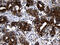 Ribonuclease A Family Member 11 (Inactive) antibody, M17007, Boster Biological Technology, Immunohistochemistry paraffin image 