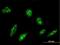 Origin Recognition Complex Subunit 4 antibody, H00005000-M05, Novus Biologicals, Immunofluorescence image 