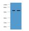 Alpha-L-Fucosidase 2 antibody, LS-C211513, Lifespan Biosciences, Western Blot image 