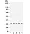 TIMP Metallopeptidase Inhibitor 2 antibody, R31978, NSJ Bioreagents, Western Blot image 