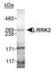 Leucine Rich Repeat Kinase 2 antibody, PA1-16990, Invitrogen Antibodies, Western Blot image 
