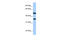 DnaJ Heat Shock Protein Family (Hsp40) Member B6 antibody, 26-652, ProSci, Enzyme Linked Immunosorbent Assay image 