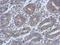 HAUS Augmin Like Complex Subunit 4 antibody, GTX106731, GeneTex, Immunohistochemistry paraffin image 