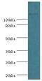 SWI/SNF Related, Matrix Associated, Actin Dependent Regulator Of Chromatin Subfamily C Member 2 antibody, LS-C378925, Lifespan Biosciences, Western Blot image 