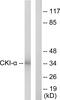 Casein Kinase 1 Alpha 1 antibody, GTX88000, GeneTex, Western Blot image 
