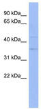 THO Complex 3 antibody, TA343952, Origene, Western Blot image 