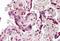 BCL2 Associated Athanogene 4 antibody, GTX88531, GeneTex, Immunohistochemistry paraffin image 