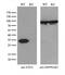 Electron transfer flavoprotein subunit alpha, mitochondrial antibody, M05572, Boster Biological Technology, Western Blot image 